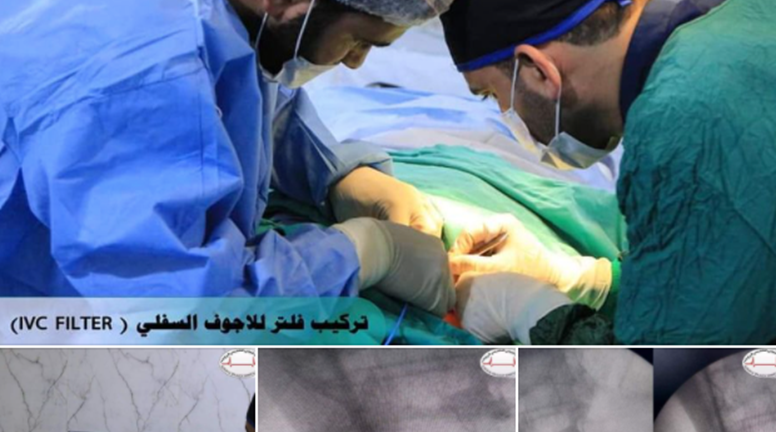 For the first time in northern Syria, a successful interventional procedure in the field of blood vessels for an elderly patient