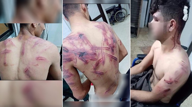 Amouda torture of a young man and two children by the Turkish gendarmerie